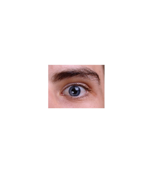 q2